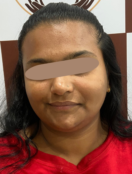 After Skin Brightening