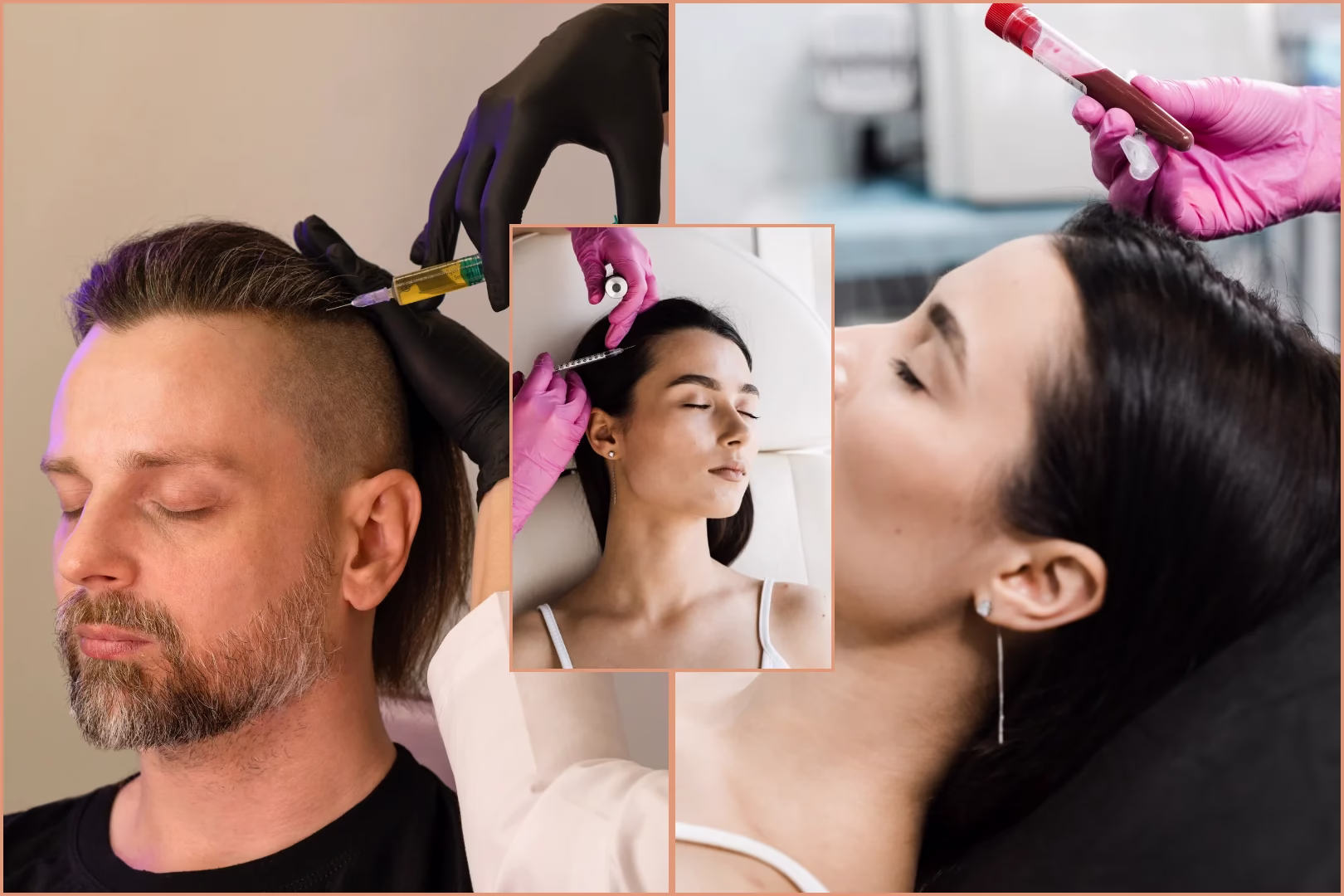 Treatments for Hair at Madhuram Ozone: Best Hair Treatment Clinic in Rajkot